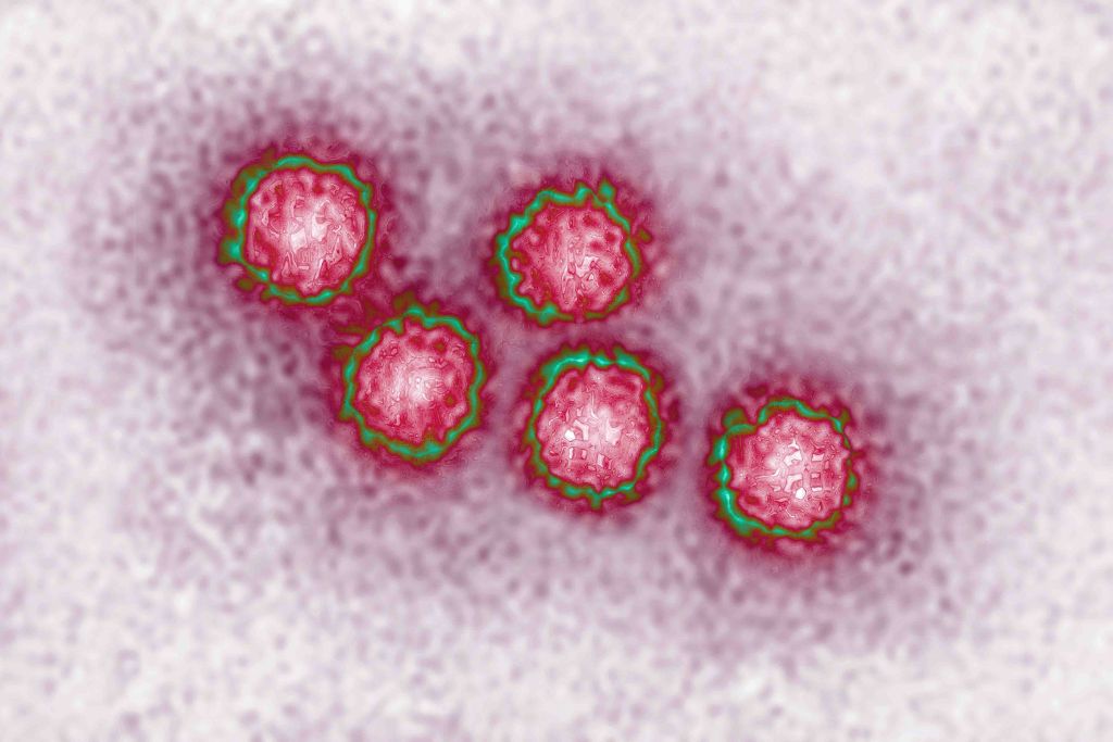 Hepatitis a virus