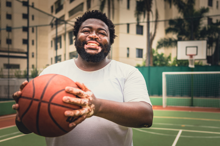 Man with vitiligo and basketball in hand