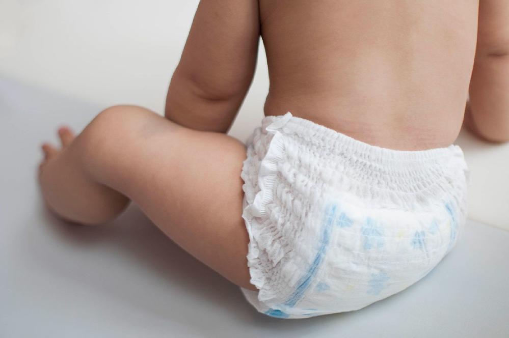 Baby wearing diaper (Karl Tapales/Moment RF/Getty Images via CNN Newsource)